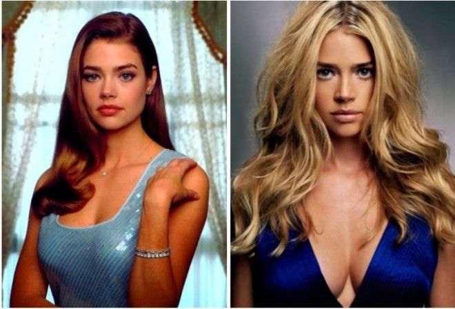 Топ8 знаменитостей которые легли под нож хирурга в слишком юном возрасте