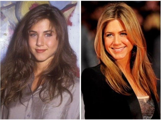 Топ8 знаменитостей которые легли под нож хирурга в слишком юном возрасте